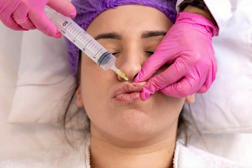 Injectable Filler / Lip Augmentation treatment