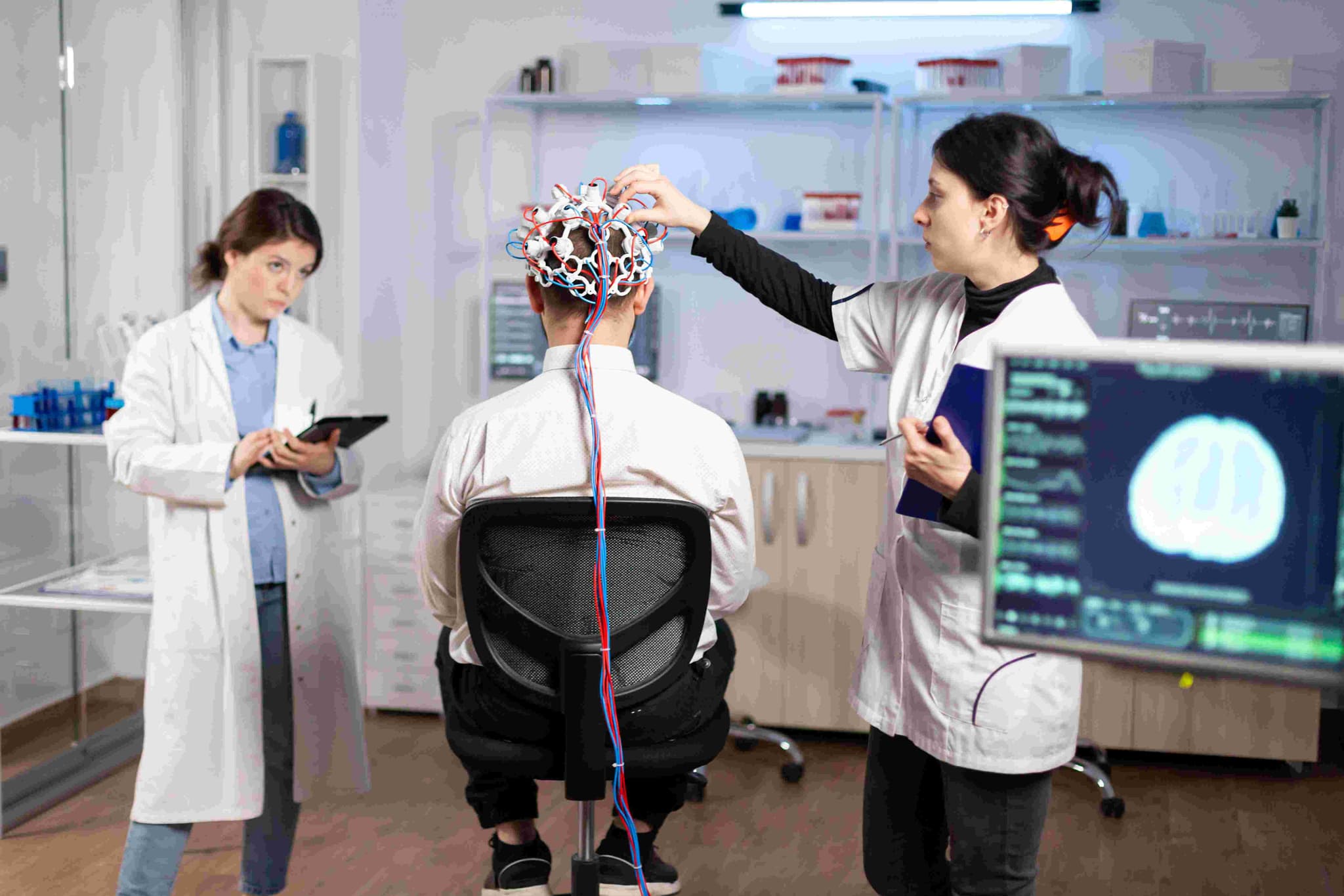 Dural AV Fistula Embolization treatment