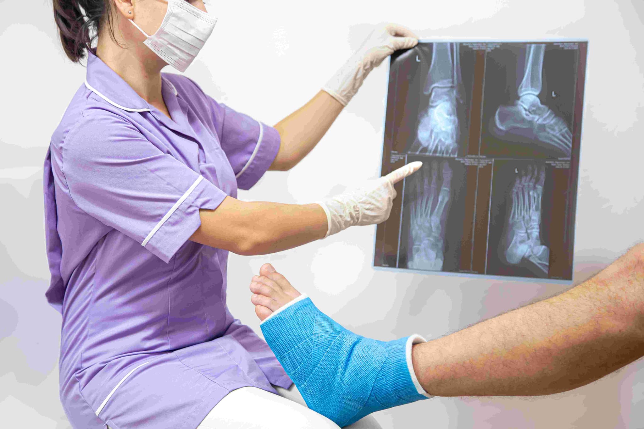 Ankle Arthroscopy treatment