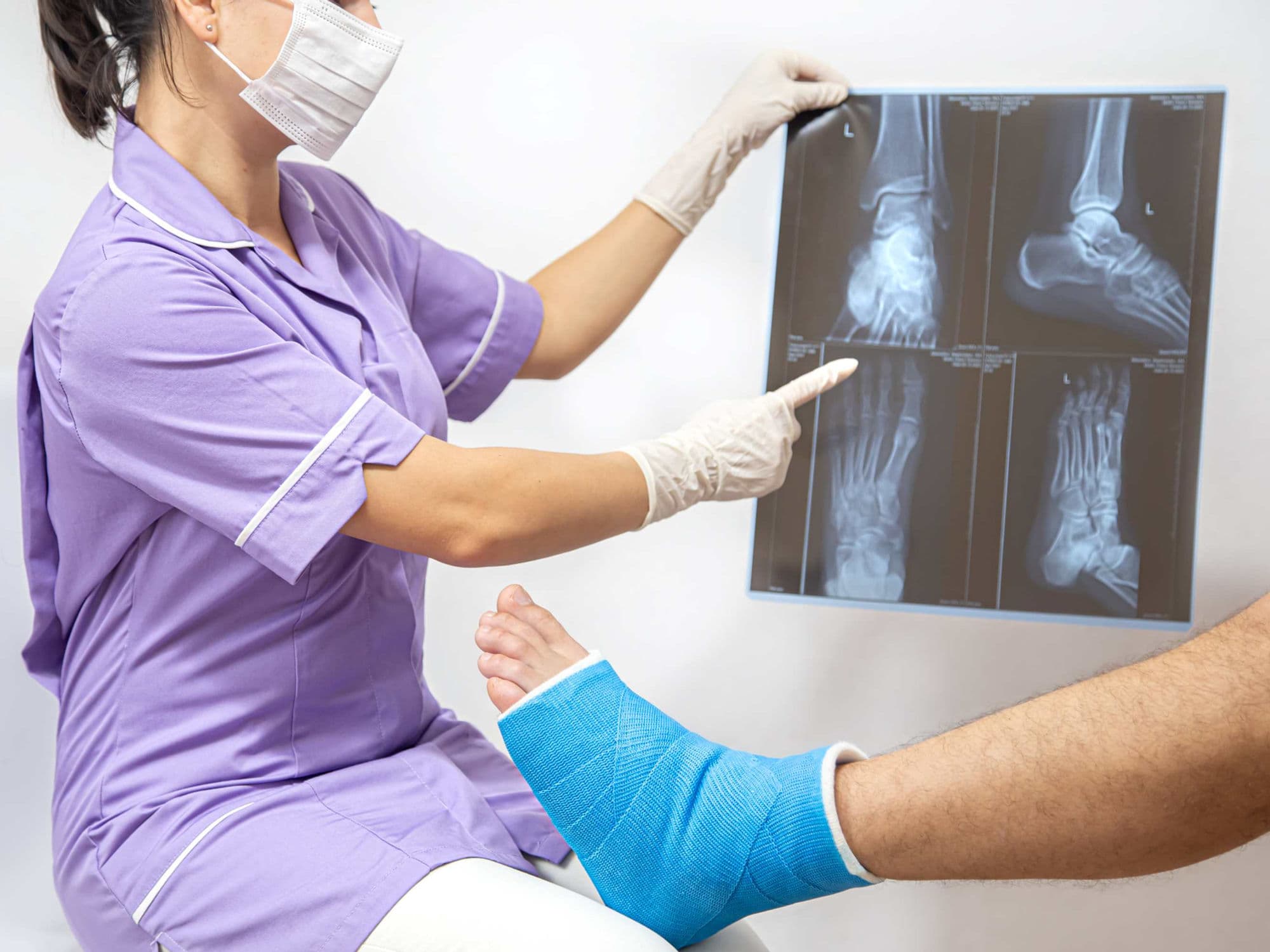 Limb Salvage Surgery treatment