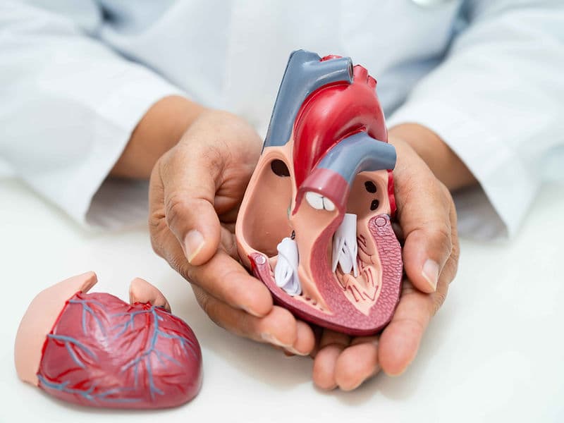 TMVI/TMVR (Transcatheter Mitral Valve Replacement)