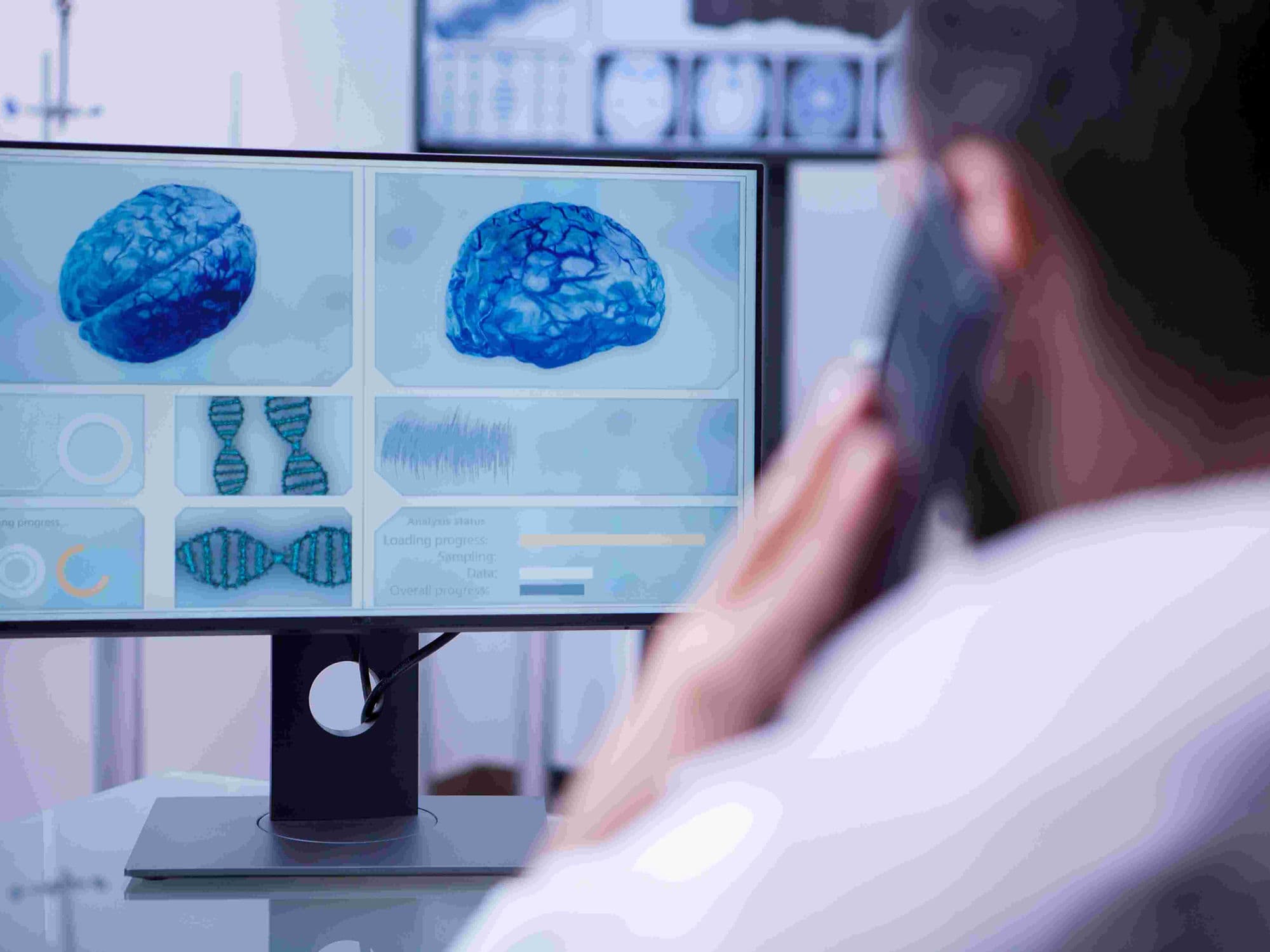 Acoustic Neuroma Surgery treatment