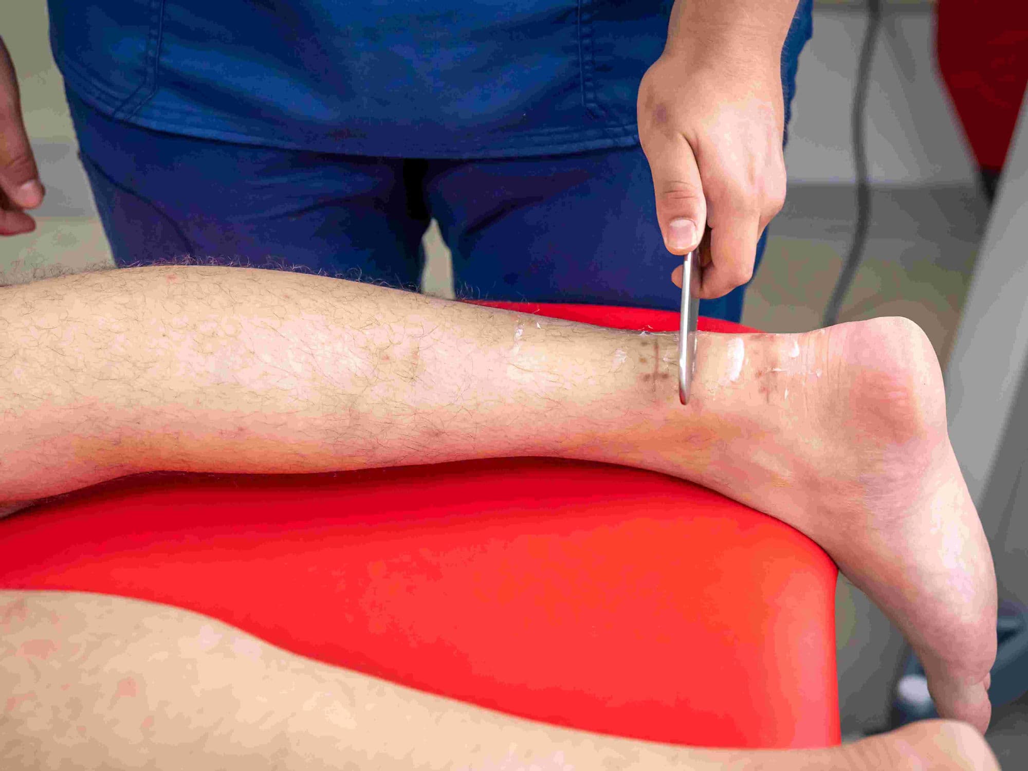 Peripheral Bypass Surgery (Leg arteries) treatment