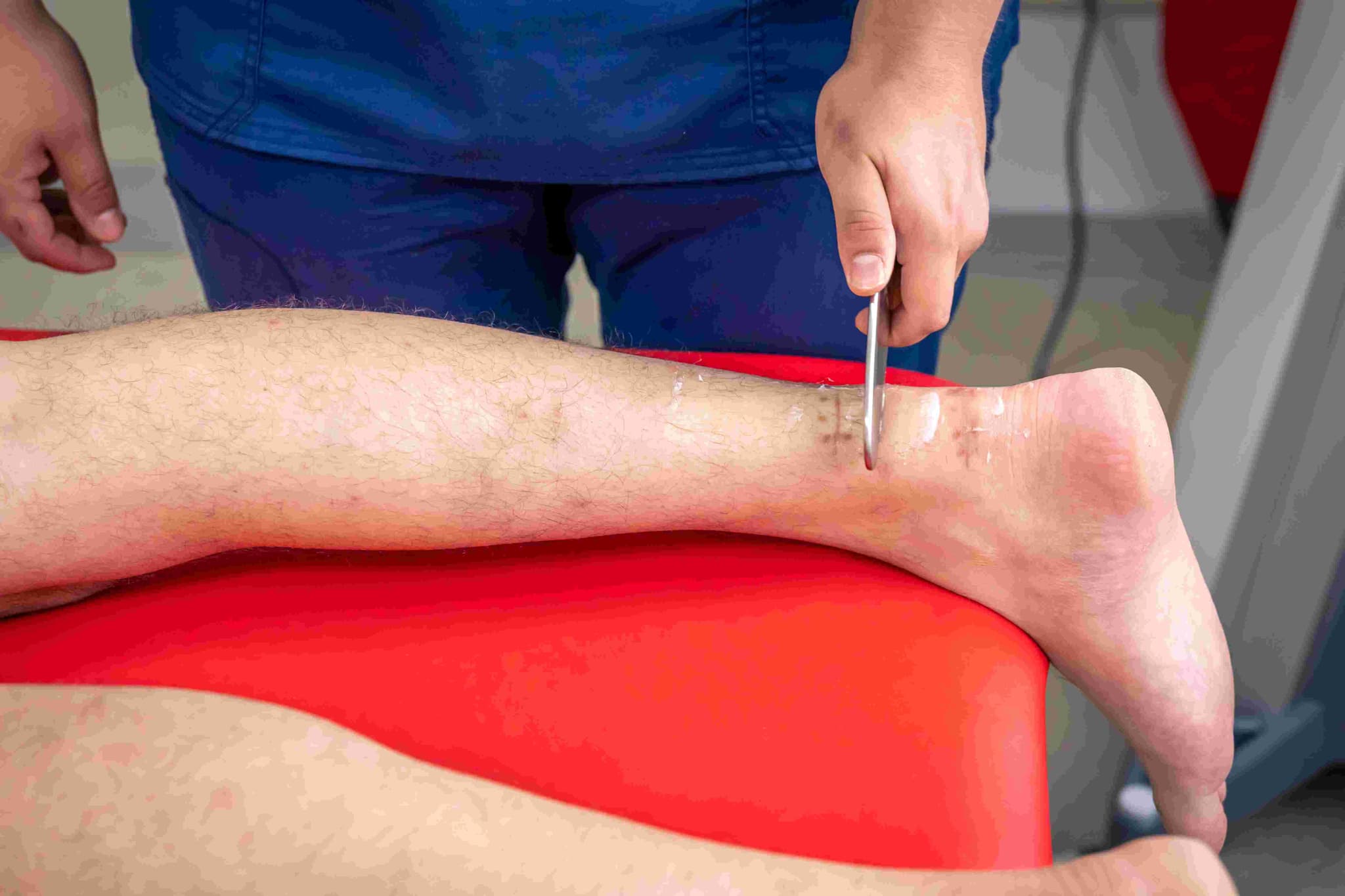 Peripheral Bypass Surgery (Leg arteries) hospital