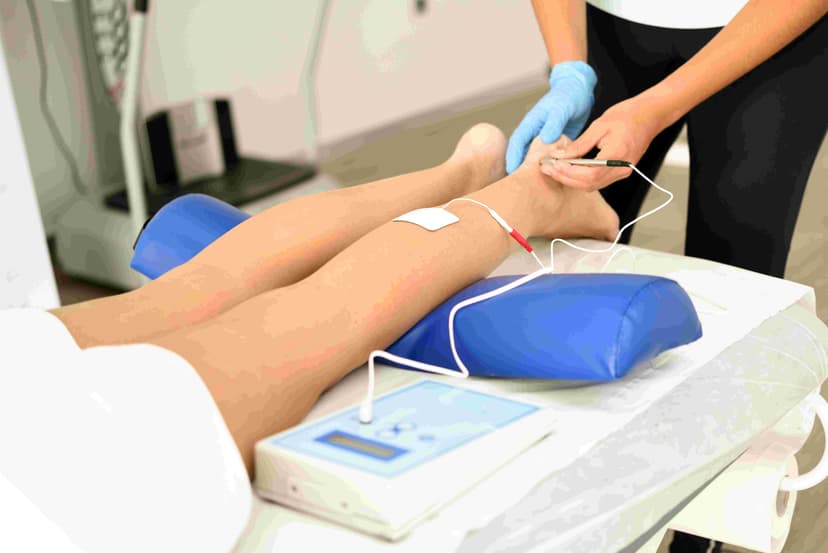 Laser Varicose Vein Treatment