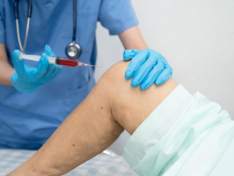 Arthrocentesis (Joint Aspiration) treatment