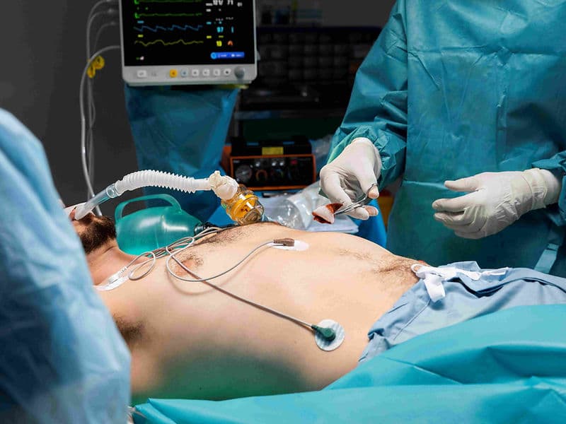 ECMO Cannulation