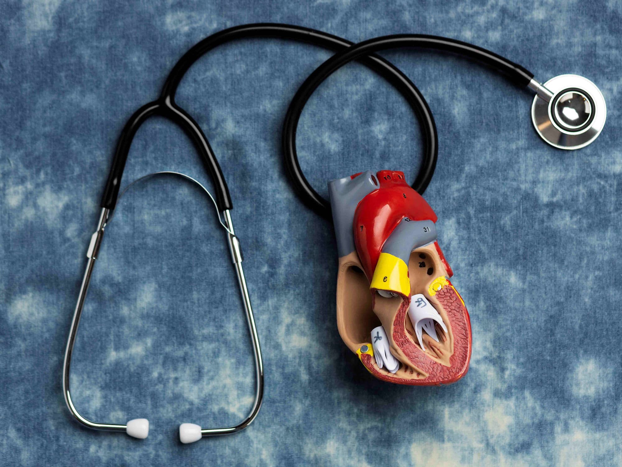 Cardiac Tumour Removal Surgery treatment