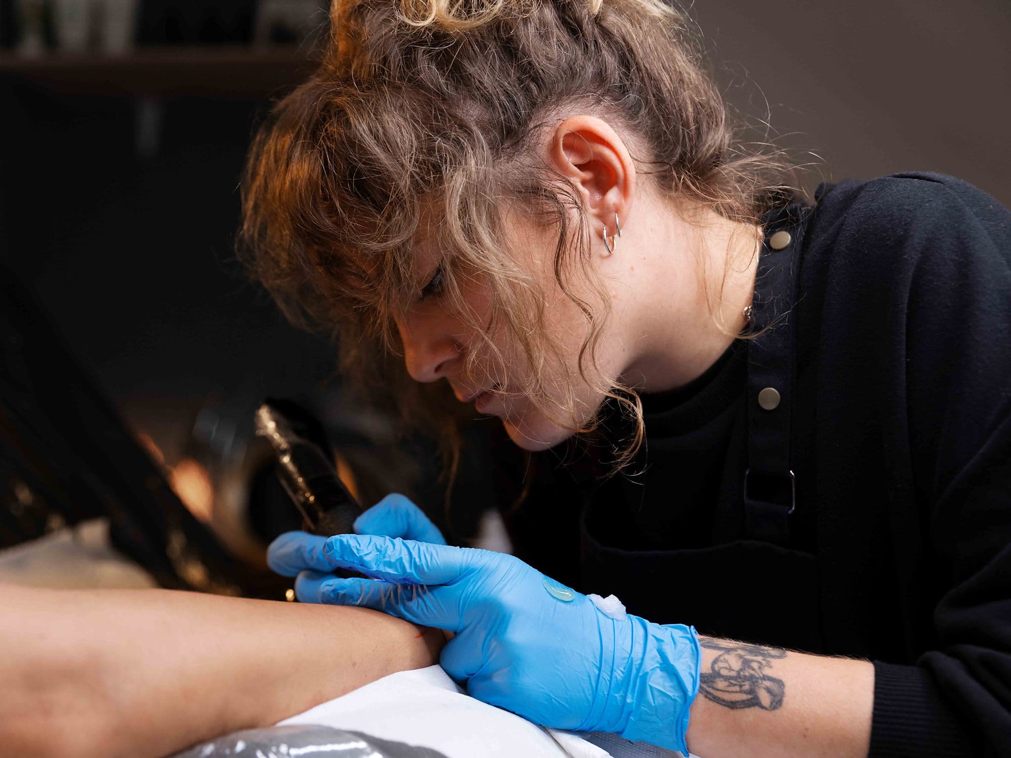 Tattoo Removal by Laser treatment