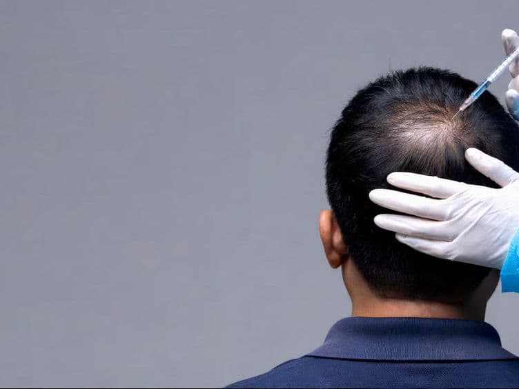 Hair Transplant Surgery treatment