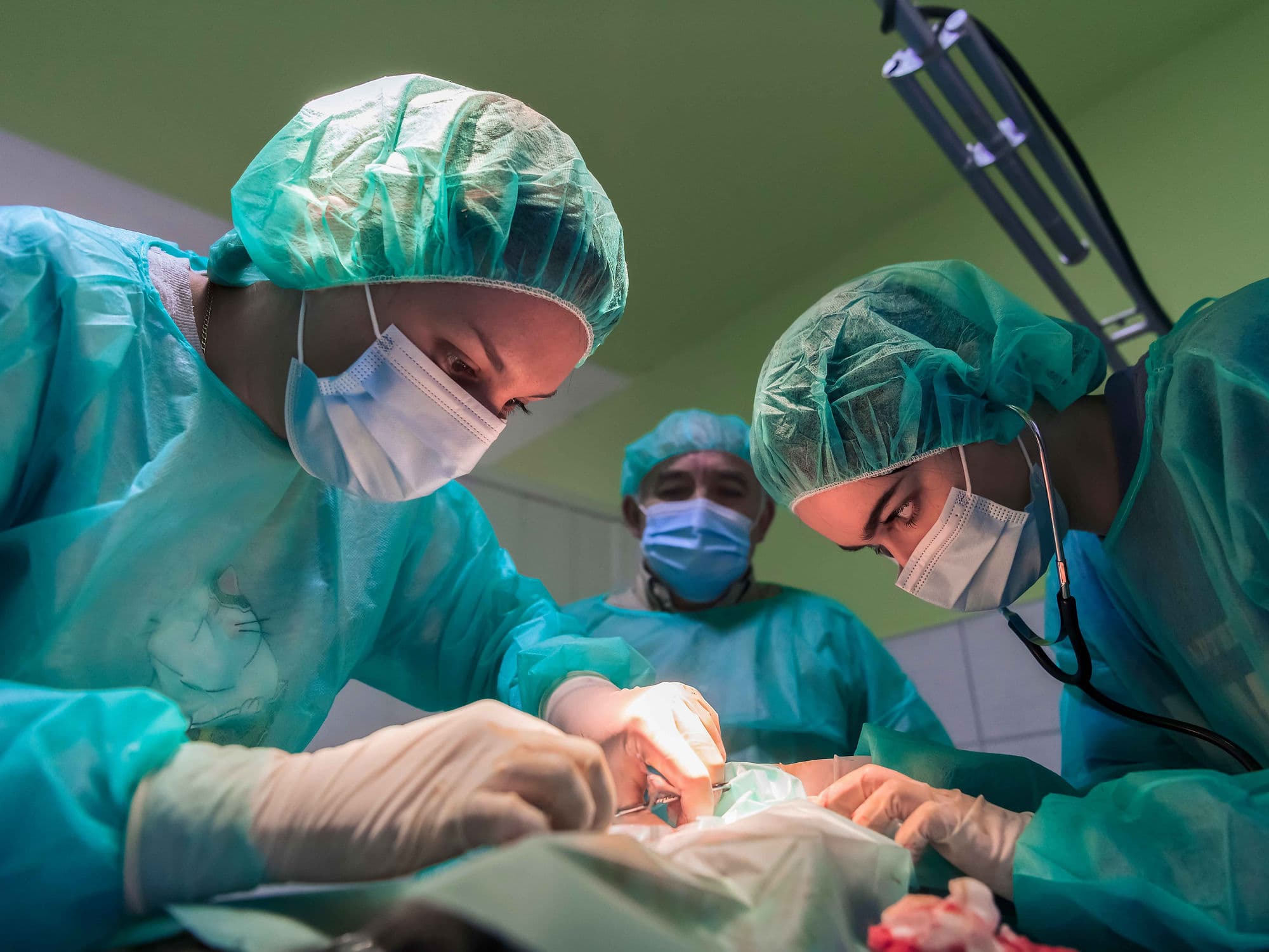 Carotid Endarterectomy treatment