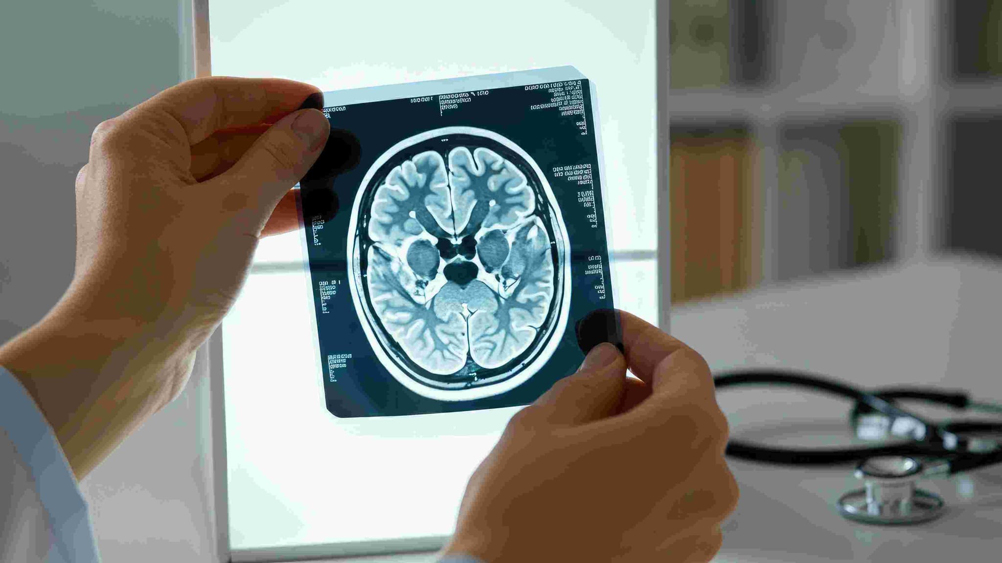 Aneurysm Clipping hospital