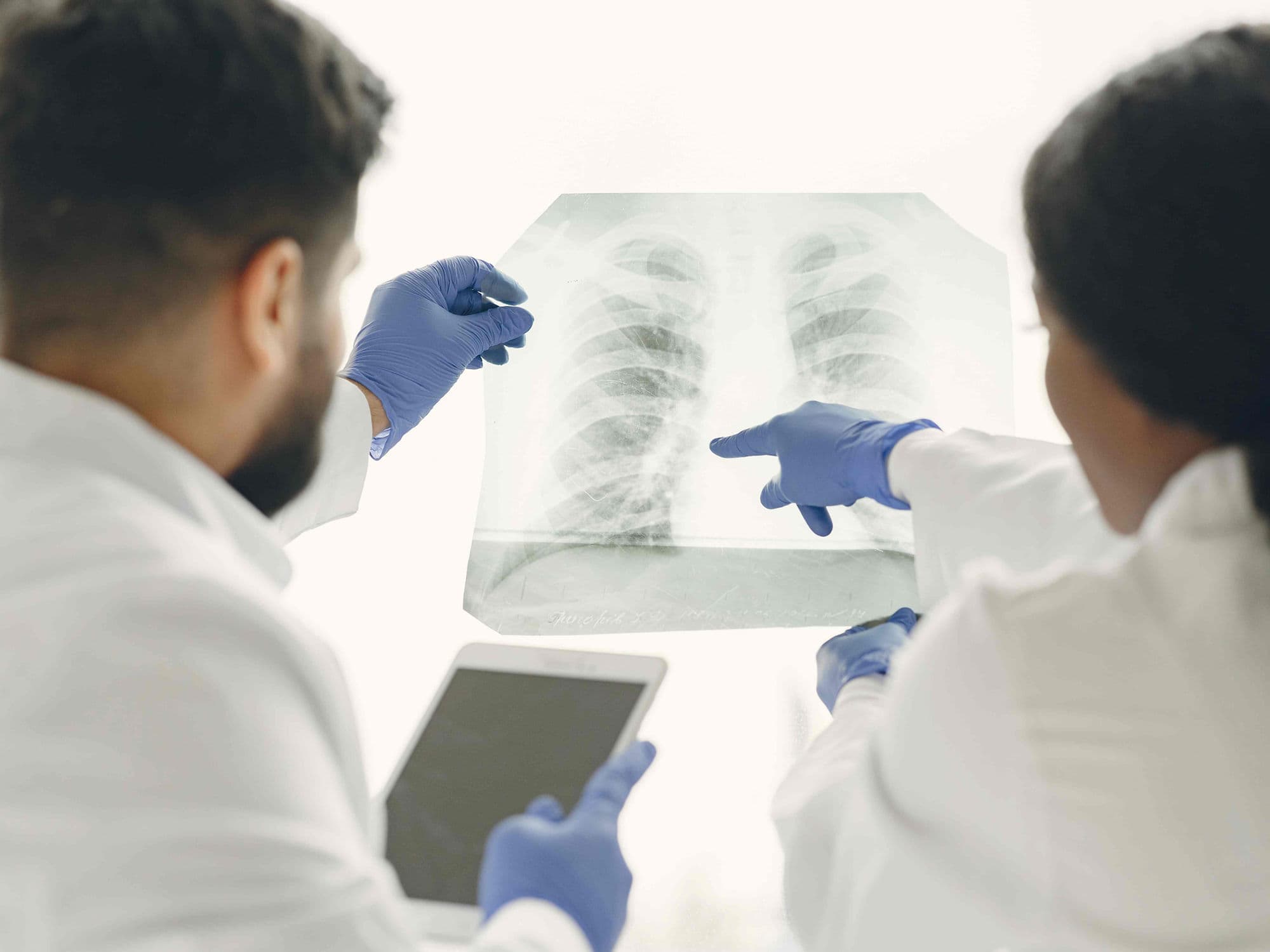Lobectomy (Cancer) treatment