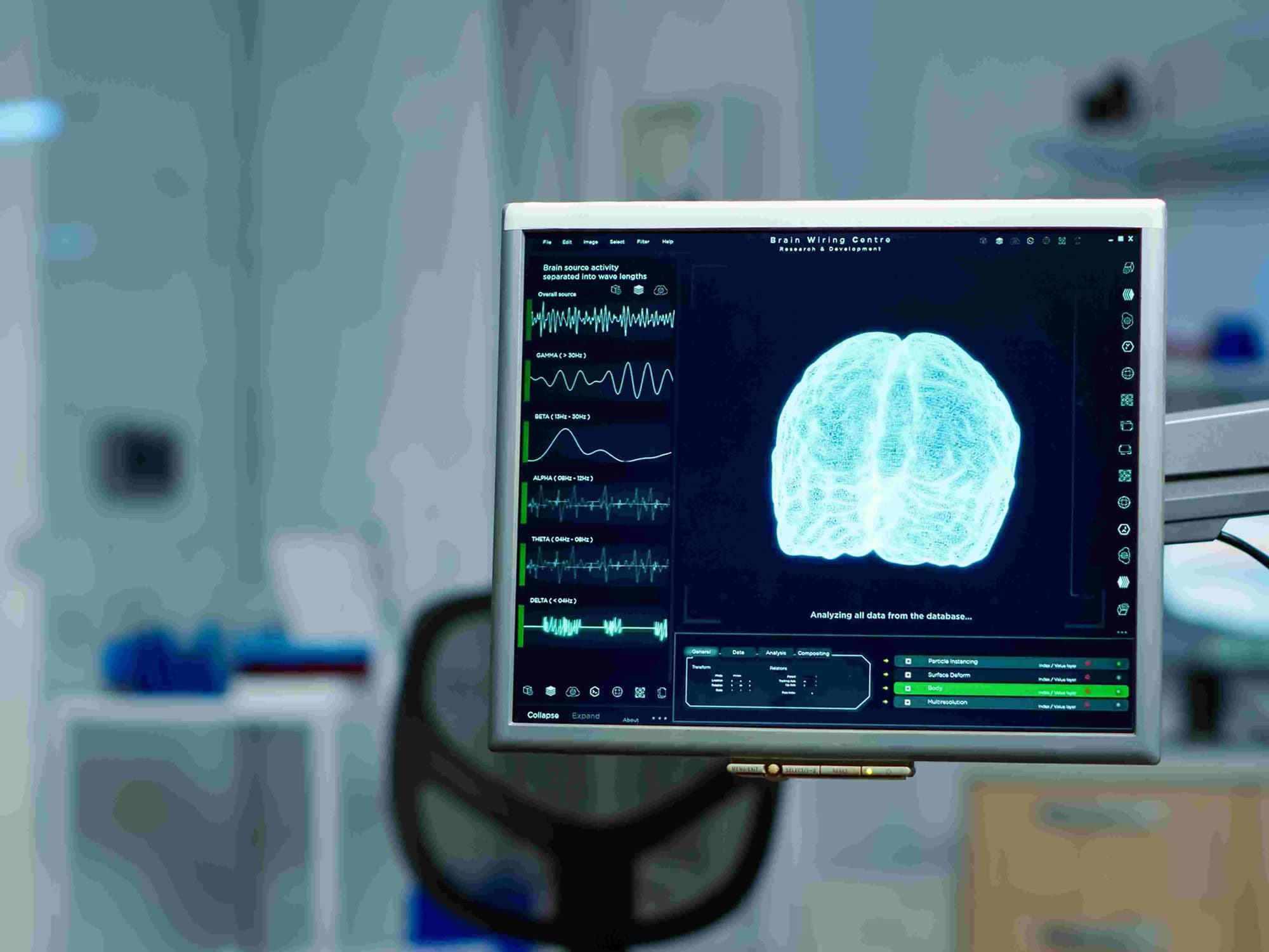 Intracranial Artery Stenting treatment